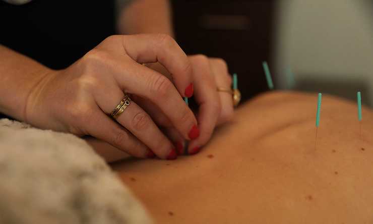 <strong>Candace Billings, founder of the Sundara Wellness Center, demonstrates her acupuncture technique on Ashley Johnson on Tuesday, Sept. 25. In addition to acupuncture, the holistic clinic also offers Chinese medicine, massage therapy, Pilates and yoga.</strong> (Patrick Lantrip/Daily Memphian)