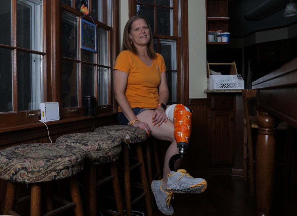 <strong>Catherine Davenport shows off her University of Tennessee prosthetic leg inside her home. &ldquo;I&rsquo;ve been a Tennessee fan forever,&rdquo; she said.</strong> (Patrick Lantrip/The Daily Memphian)